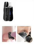 Aspirateur Point Noirs,Nettoyeur De Pores Scraper Ion Import Exporter Usb, Noir