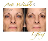 24K Gold Masque